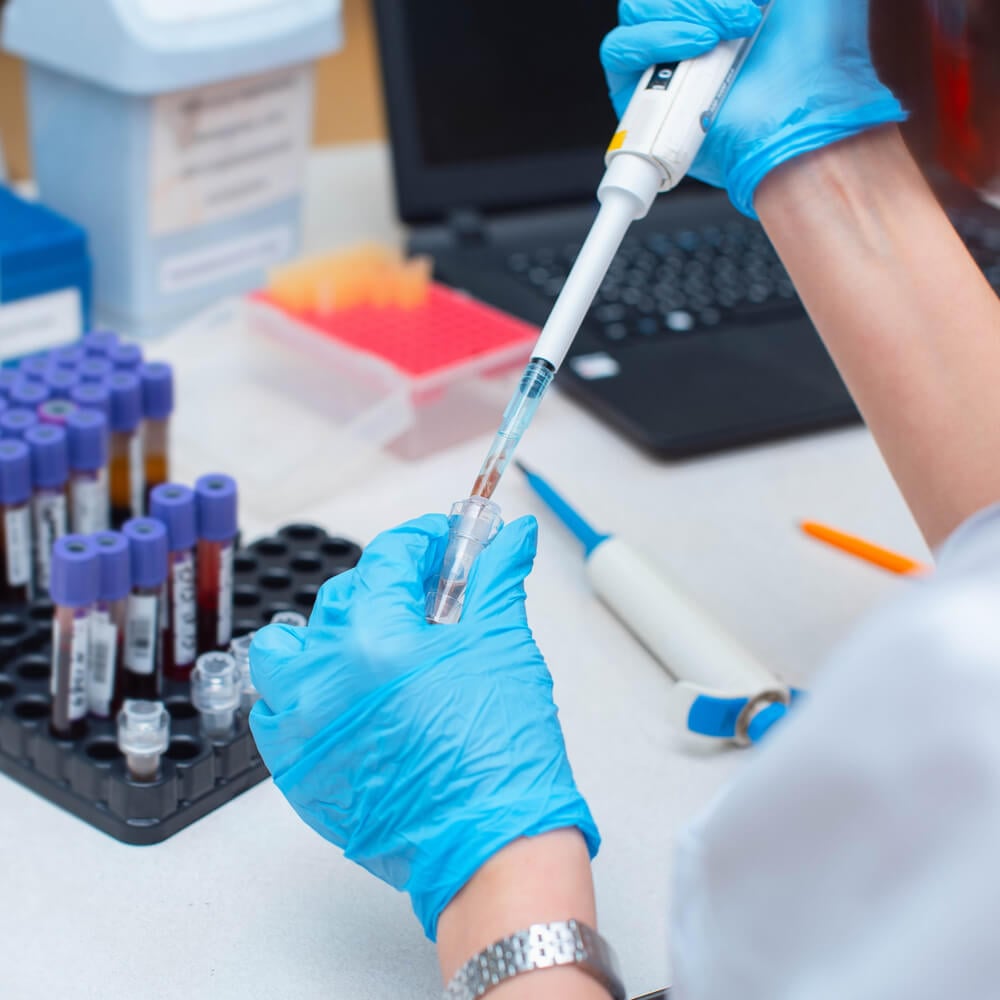 Blood test in the laboratory