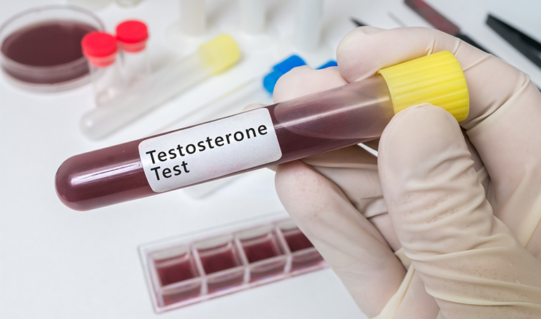 Testosterone Test: Understanding The Levels And What They Tell You