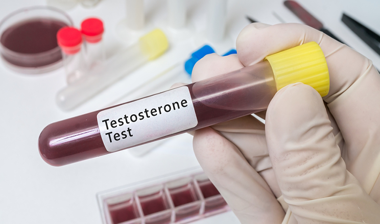 What Are Normal Testosterone Levels In Men?