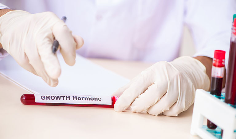 Growth Hormone (HGH) Test: Procedure, Outcome, And More